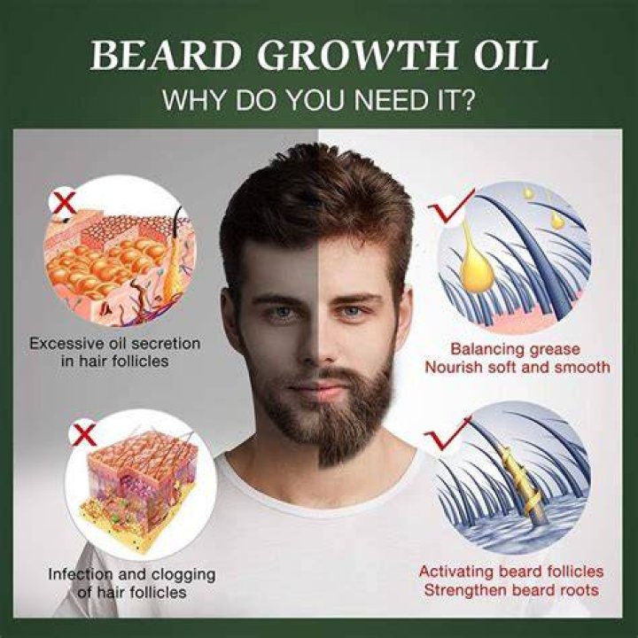 Does Beard Oil Help Beard Grow: A Comprehensive Guide