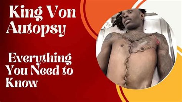 King Von Autopsy Photo: An In-Depth Analysis and Impact on Fans and Media