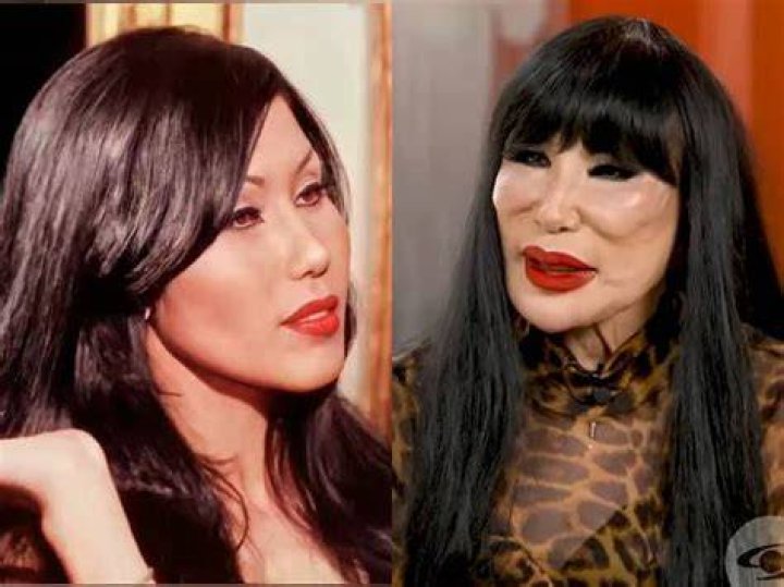 What Happened to Lyn May's Face? A Deep Dive into the Controversy and Transformation